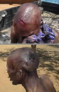 Injuries inflicted by thugs