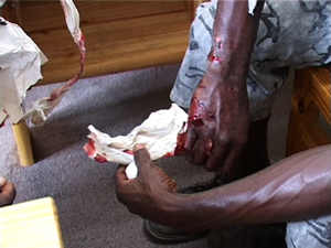 Mar 6, 2002 - CM was confronted at his house at 11am and was then cut on the right forearm five times with a knife