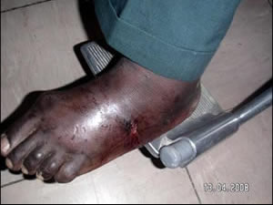 Reprisal attacks against voters in Zimbabwe