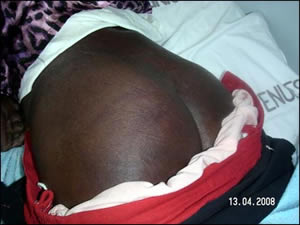 Reprisal attacks against voters in Zimbabwe