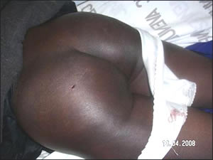 Reprisal attacks against voters in Zimbabwe