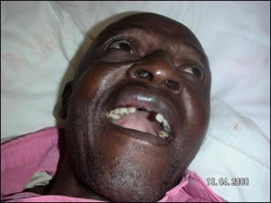 Reprisal attacks against voters in Zimbabwe