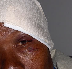 This is one of the WOZA women who sustained head injuries.