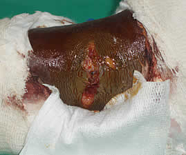 One of the women sustained a broken ankle after being beaten by the riot police.